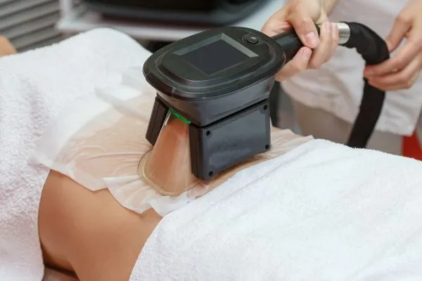 Image of person having fat freezing treatment to help weight gain Perth