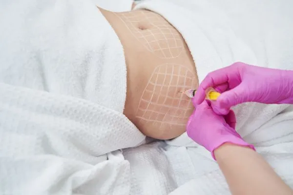 image of fat dissolving injections on love handles to help combat weight gain Perth