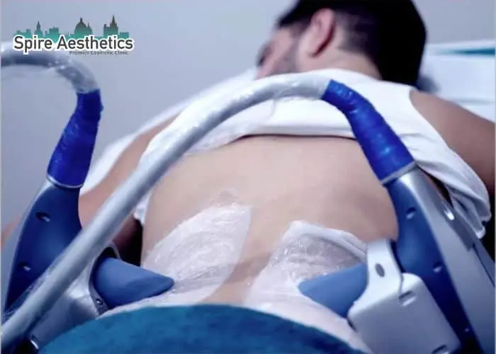 Man having fat freezing treatment done on love handles before a competitions Perth to create a sculpted look.