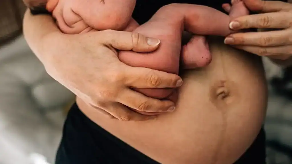 Why Is My Stomach Still Big After Pregnancy Perth?